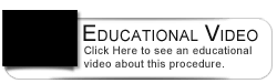 Dental Education Video - Micro Ultrasonic Scaling